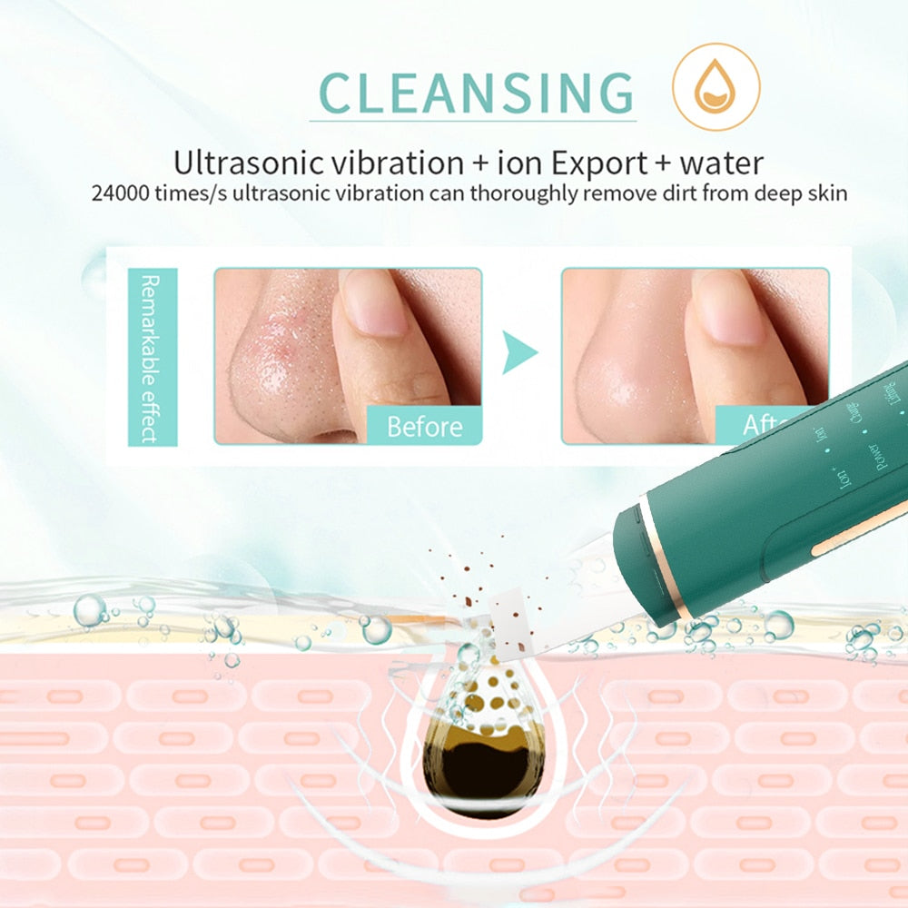 Ultrasonic Deep Cleaning Massager for Face Skin Care