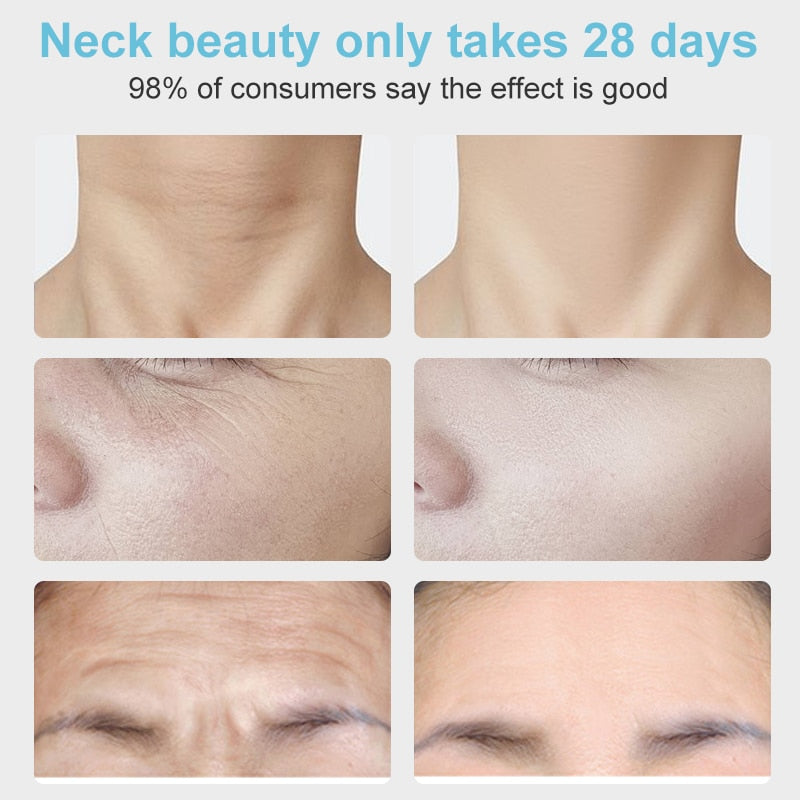 Neck Anti Wrinkle Face Lifting Beauty Device